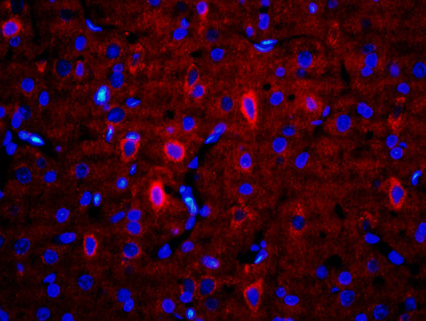 Formalin-fixed and paraffin-embedded rat brain labeled with Anti-RALDH2 Polyclonal Antibody, Unconjugated(bs-3676R) 1:200, overnight at 4°C, The secondary antibody was Goat Anti-Rabbit IgG,Cy3 conjugated(bs-0295G-Cy3)used at 1:200 dilution for 40 minutes at 37°C.\n