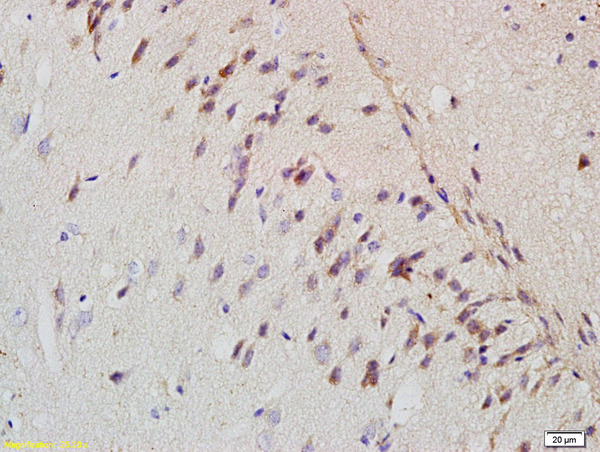 Formalin-fixed and paraffin embedded rat brain labeled with Rabbit Anti-APP\/Amyloid Precursor Protein Polyclonal Antibody (bs-0112R) at 1:200 followed by conjugation to the secondary antibody and DAB staining.