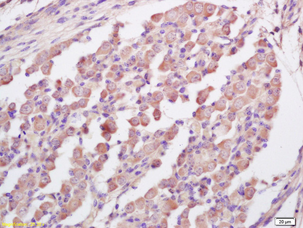 Formalin-fixed and paraffin embedded mouse embryo labeled with Anti-RNF123 Polyclonal Antibody, Unconjugated (bs-9249R) at 1:200 followed by conjugation to the secondary antibody and DAB staining Formalin-fixed and paraffin embedded mouse embryo labeled with Anti-RNF123 Polyclonal Antibody, Unconjugated (bs-9249R) at 1:200 followed by conjugation to the secondary antibody and DAB staining