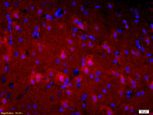 Formalin-fixed and paraffin-embedded rat brain labeled with Mouse Anti-Alpha-Synuclein Polyclonal Antibody, Unconjugated(bs-0012M) 1:200, overnight at 4°C, The secondary antibody was Goat Anti-Rabbit IgG, Cy3 conjugated(bs-0295G-Cy3)used at 1:200 dilution for 40 minutes at 37°C.