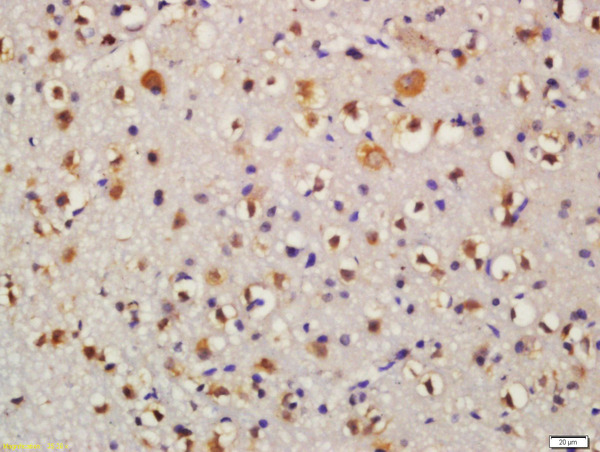 Formalin-fixed and paraffin embedded mouse brain labeled with Anti-Bid Polyclonal Antibody, Unconjugated (bs-1153R) at 1:200 followed by conjugation to the secondary antibody and DAB staining\n