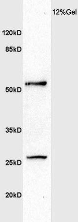 Human colon carcinoma lysate probed with Anti MMP1 Polyclonal Antibody, Unconjugated (bs-0424R) at 1:200 overnight at 4˚C. Followed by conjugation to secondary antibody (bs-0295G-HRP) at 1:3000 for 90 min at 37˚C. Predicted band 54kD. Observed band size: 27kD and 54kD