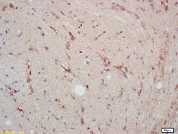 Formalin-fixed and paraffin embedded rat brain labeled with  Rabbit Anti p38MAPK\/MAPK14\/p38Alpha Polyclonal Antibody, Unconjugated (bs-0637R) at 1:200 followed by conjugation to the secondary antibody and DAB staining