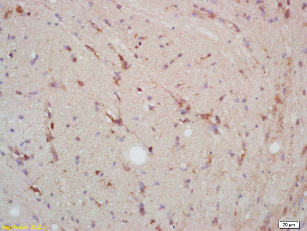 Formalin-fixed and paraffin embedded rat brain labeled with Rabbit Anti p38MAPK/MAPK14/p38Alpha Polyclonal Antibody, Unconjugated (bs-0637R) at 1:200 followed by conjugation to the secondary antibody and DAB staining