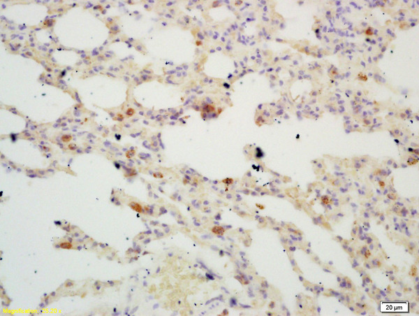 Formalin-fixed and paraffin embedded mouse lung labeled with Rabbit Anti TIGAR Polyclonal Antibody, Unconjugated (bs-0640R) at 1:200 followed by conjugation to the secondary antibody and DAB staining