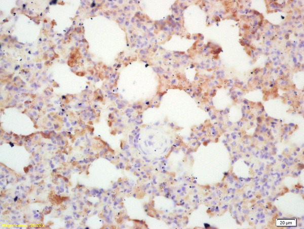 Formalin-fixed and paraffin embedded mouse lung labeled with  Rabbit Anti Integrin alpha 4\/CD49d\/Integrin \u03b14 Polyclonal Antibody, Unconjugated (bs-0641R) at 1:200 followed by conjugation to the secondary antibody and DAB staining