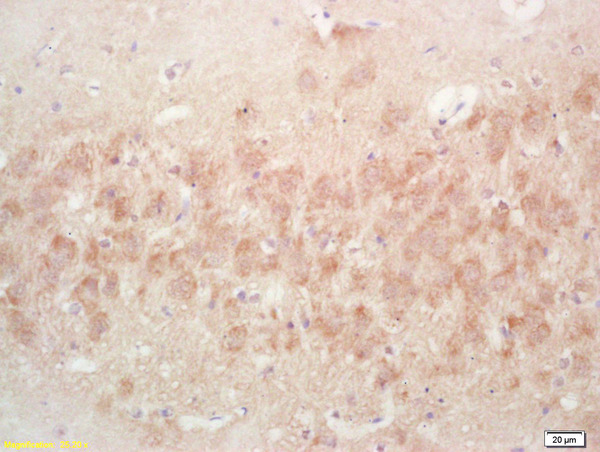 Formalin-fixed and paraffin embedded rat brain labeled with Rabbit Anti PAK7/PAK5/MBT Polyclonal Antibody, Unconjugated (bs-0655R) at 1:200 followed by conjugation to the secondary antibody and DAB staining