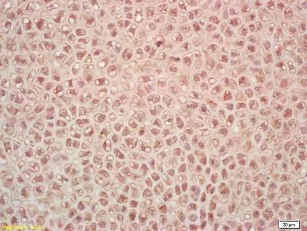 Formalin-fixed and paraffin embedded mouse embryo labeled with Rabbit Anti PAK7/PAK5/MBT Polyclonal Antibody, Unconjugated (bs-0655R) at 1:200 followed by conjugation to the secondary antibody and DAB staining