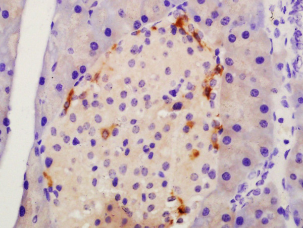 Formalin-fixed and paraffin embedded mouse pancreas labeled with Anti-TMEM49 Polyclonal Antibody, Unconjugated (bs-6740R) at 1:200 followed by conjugation to the secondary antibody and DAB staining\n Formalin-fixed and paraffin embedded mouse pancreas labeled with Anti-TMEM49 Polyclonal Antibody, Unconjugated (bs-6740R) at 1:200 followed by conjugation to the secondary antibody and DAB staining\n