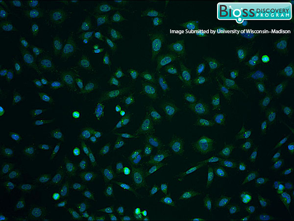 This image was kindly submitted by Dr. Lajoie from the University of Wisconsin-Madison.\n4% PFA fixed rat brain vascular endothelial cells (RBE4) labeled with RABBIT ANTI-ITM2A POLYCLONAL ANTIBODY, UNCONJUGATED (BS-9705R) 1:100 dilution, followed by conjugated secondary antibody and DAPI staining. Anti-ITM2A staining is shown in green with blue DAPI counterstain.