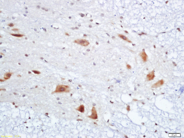 Formalin-fixed and paraffin embedded rat spinal cord labeled with Anti-PMP22 Polyclonal Antibody, Unconjugated (bs-0235R) at 1:200 followed by conjugation to the secondary antibody and DAB staining\\n
