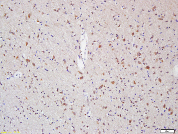 Formalin-fixed and paraffin embedded rat brain labeled with Anti-Myelin Protein Zero Polyclonal Antibody, Unconjugated (bs-0337R) at 1:200 followed by conjugation to the secondary antibody and DAB staining\\n
