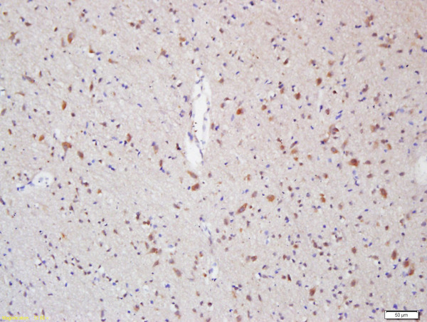 Formalin-fixed and paraffin embedded rat brain labeled with Anti-Myelin Protein Zero Polyclonal Antibody, Unconjugated (bs-0337R) at 1:200 followed by conjugation to the secondary antibody and DAB staining\n