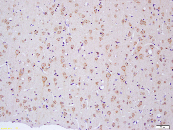 Formalin-fixed and paraffin embedded rat brain labeled with Anti-NF2\/Neurofibromin 2 Polyclonal Antibody, Unconjugated (bs-1366R) at 1:200 followed by conjugation to the secondary antibody and DAB staining\\n