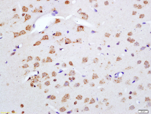 Formalin-fixed and paraffin embedded rat brain labeled with Anti-Phospho-Merlin(Ser518) Polyclonal Antibody, Unconjugated (bs-3291R) at 1:200 followed by conjugation to the secondary antibody and DAB staining\\n