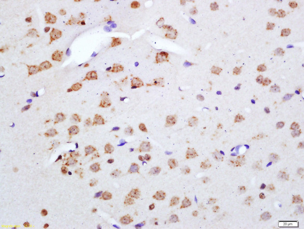 Formalin-fixed and paraffin embedded rat brain labeled with Anti-Phospho-Merlin(Ser518) Polyclonal Antibody, Unconjugated (bs-3291R) at 1:200 followed by conjugation to the secondary antibody and DAB staining\n