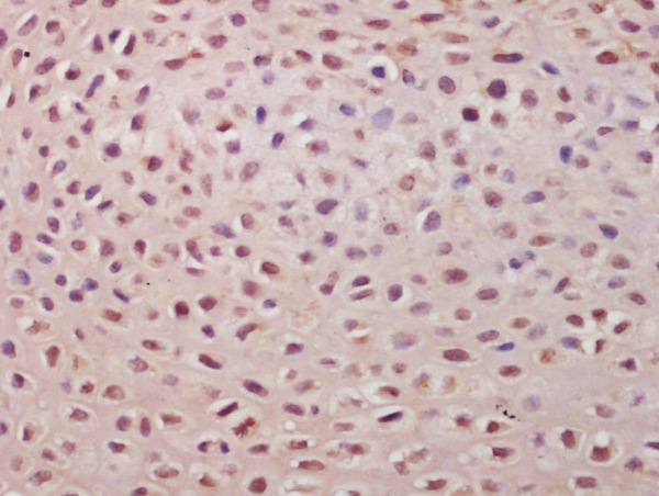Formalin-fixed and paraffin embedded mouse embryo labeled with Anti-TSPYL5 Polyclonal Antibody, Unconjugated (bs-7703R) at 1:200 followed by conjugation to the secondary antibody and DAB staining\n