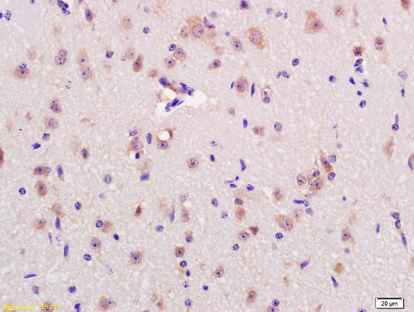 Formalin-fixed and paraffin embedded rat brain labeled with Anti-RNF123 Polyclonal Antibody, Unconjugated (bs-9249R) at 1:200 followed by conjugation to the secondary antibody and DAB staining