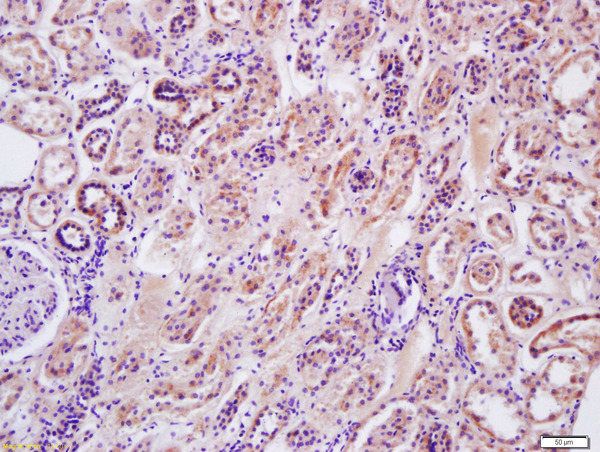 Formalin-fixed and paraffin embedded human kidney labeled with Anti-Arginase II Polyclonal Antibody, Unconjugated (bs-11397R) at 1:200 followed by conjugation to the secondary antibody and DAB staining