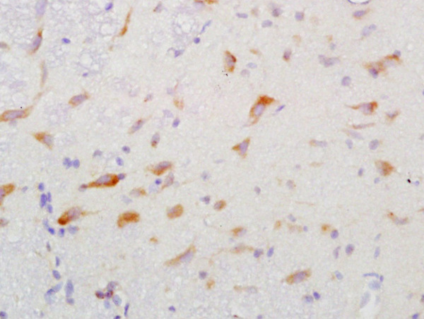 Formalin-fixed and paraffin embedded rat brain labeled with Anti-GGA2 Polyclonal Antibody, Unconjugated (bs-13344R) at 1:200 followed by conjugation to the secondary antibody and DAB staining\n