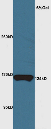 Mouse brain lysate probed with Rabbit Anti-MRF\/C11orf9 Polyclonal Antibody, Unconjugated (bs-11191R) at 1:200 overnight at 4˚C. Followed by conjugation to secondary antibody (bs-0295G-HRP) at 1:3000 for 90 min at 37˚C. Predicted band 124kD. Observed band size: 124kD