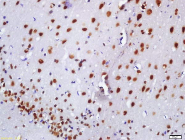 Formalin-fixed and paraffin embedded rat brain labeled with Anti-BASP1 Polyclonal Antibody, Unconjugated (bs-8662R) at 1:200 followed by conjugation to the secondary antibody and DAB staining\n Formalin-fixed and paraffin embedded rat brain labeled with Anti-BASP1 Polyclonal Antibody, Unconjugated (bs-8662R) at 1:200 followed by conjugation to the secondary antibody and DAB staining\n