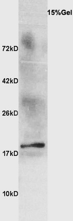 Ewe's milk probed with Anti Beta-lactoglobulin Polyclonal Antibody, Unconjugated (bs-0814R) at 1:300 overnight at 4˚C. Followed by conjugation to secondary antibody (bs-0295G-HRP) at 1:3000 for 90 min at 37˚C. Predicted band 19kD. Observed band size: 19kD