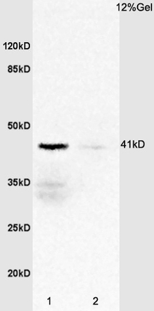 L1 rat spleen lysates L2 mouse heart lysates probed with Anti IL-2R gamma\/CD132 Polyclonal Antibody, Unconjugated (bs-2545R) at 1:200 overnight at 4˚C. Followed by conjugation to secondary antibody (bs-0295G-HRP) at 1:3000 for 90 min at 37˚C. Predicted band 41kD. Observed band size:41kD.\\n