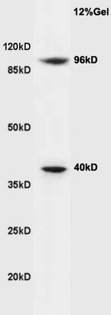 Mouse brain lysates probed with Anti Cyclin M2 Polyclonal Antibody, Unconjugated (bs-6912R) at 1:200 overnight at 4˚C. Followed by conjugation to secondary antibody (bs-0295G-HRP) at 1:3000 for 90 min at 37˚C. Mouse brain lysates probed with Anti Cyclin M2 Polyclonal Antibody, Unconjugated (bs-6912R) at 1:200 overnight at 4˚C. Followed by conjugation to secondary antibody (bs-0295G-HRP) at 1:3000 for 90 min at 37˚C.