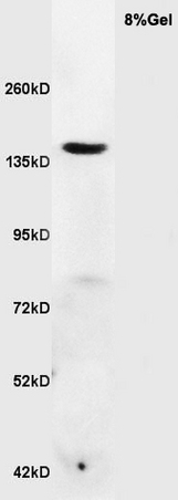Mouse brain probed with Anti RNF123 Polyclonal Antibody, Unconjugated (bs-2530R) at 1:200 overnight at 4˚C. Followed by conjugation to secondary antibody (bs-0295G-HRP) at 1:3000 for 90 min at 37˚C.