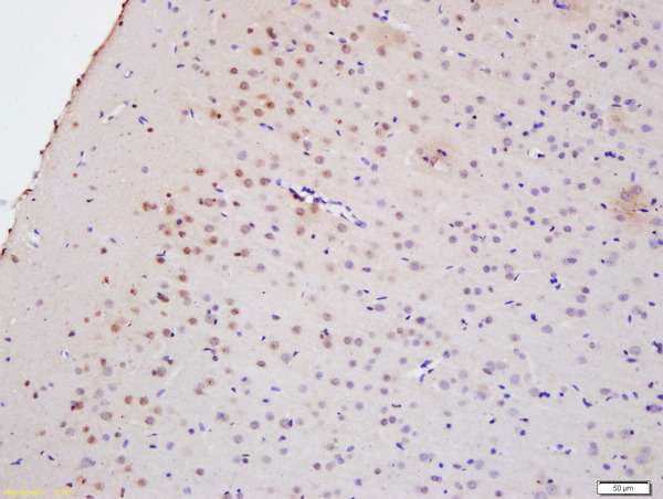 Formalin-fixed and paraffin embedded rat brain labeled with Anti-Myelin PLP  Polyclonal Antibody, Unconjugated (bs-11093R) at 1:200 followed by conjugation to the secondary antibody and DAB staining\\n