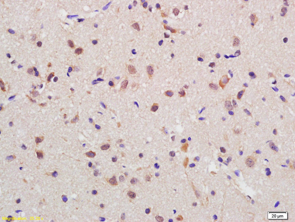 Formalin-fixed and paraffin embedded rat brain labeled with Anti-RGC32 Polyclonal Antibody, Unconjugated (bs-9079R) at 1:200 followed by conjugation to the secondary antibody and DAB staining\n