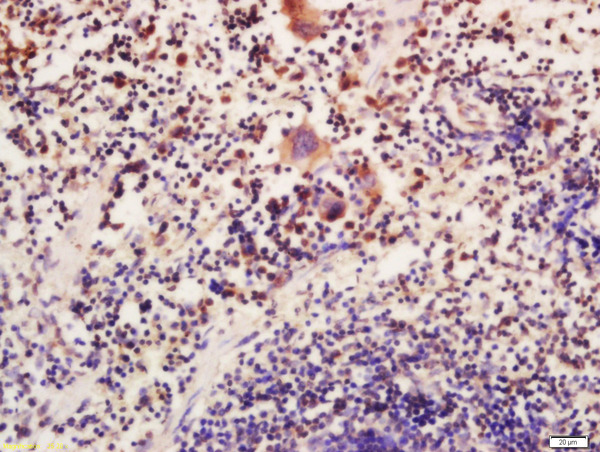 Formalin-fixed and paraffin embedded mouse spleen labeled with Anti-ATG16L Polyclonal Antibody, Unconjugated (bs-4007R) at 1:200 followed by conjugation to the secondary antibody and DAB staining
