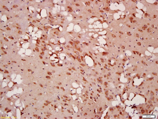 Formalin-fixed and paraffin embedded rat brain labeled with Anti-Beclin 1\/ATG6 Polyclonal Antibody, Unconjugated (bs-1353R) at 1:200 followed by conjugation to the secondary antibody and DAB staining