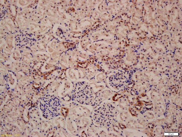 Formalin-fixed and paraffin embedded rat kidney labeled with Anti-LAMP-1 Polyclonal Antibody, Unconjugated (bs-1970R) at 1:200 followed by conjugation to the secondary antibody and DAB staining