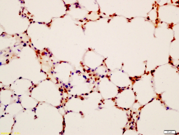 Formalin-fixed and paraffin embedded mouse lung labeled with Anti-LAMP2/CD107B Polyclonal Antibody, Unconjugated (bs-2379R) at 1:200 followed by conjugation to the secondary antibody and DAB staining