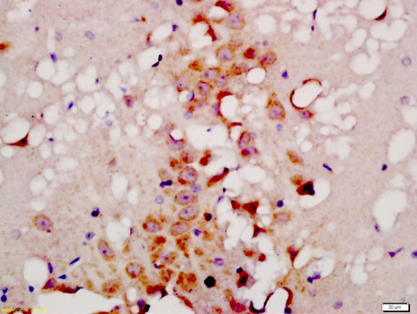 Formalin-fixed and paraffin embedded rat brain labeled with Anti-TG9B Polyclonal Antibody, Unconjugated (bs-4011R) at 1:200 followed by conjugation to the secondary antibody and DAB staining