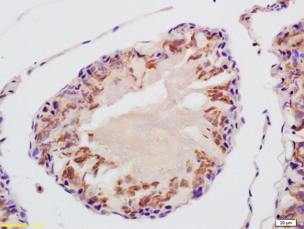 Formalin-fixed and paraffin embedded rat testis labeled with Anti-VDAC3 Polyclonal Antibody, Unconjugated (bs-7647R) at 1:200 followed by conjugation to the secondary antibody and DAB staining