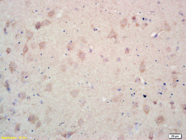 Formalin-fixed and paraffin embedded rat brain labeled with  Rabbit Anti MCK10\/CD167a\/DDR1 Polyclonal Antibody, Unconjugated (bs-0671R) at 1:200 followed by conjugation to the secondary antibody and DAB staining