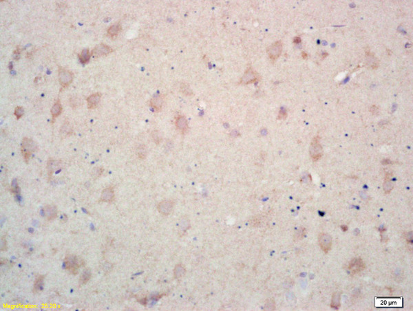 Formalin-fixed and paraffin embedded rat brain labeled with Rabbit Anti MCK10/CD167a/DDR1 Polyclonal Antibody, Unconjugated (bs-0671R) at 1:200 followed by conjugation to the secondary antibody and DAB staining