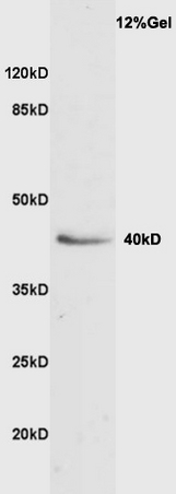 Rat liver lysate probed with Anti VASH1 Polyclonal Antibody, Unconjugated (bs-1505R) at 1:200 overnight at 4˚C. Followed by conjugation to secondary antibody (bs-0295G-HRP) at 1:3000 for 90 min at 37˚C. Predicted band 41kD. Observed band size: 40kD