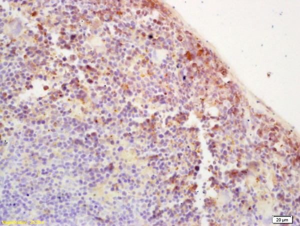 Formalin-fixed and paraffin embedded mouse spleen labeled with Rabbit Anti IGF1R/CD221 Polyclonal Antibody, Unconjugated (bs-0680R) at 1:200 followed by conjugation to the secondary antibody and DAB staining