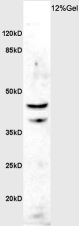 Rat brain lysate probed with Rabbit Anti-ASMTY Polyclonal Antibody, Unconjugated (bs-6961R) at 1:200 overnight at 4˚C. Followed by conjugation to secondary antibody (bs-0295G-HRP) at 1:3000 for 90 min at 37˚C.