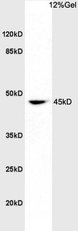 Rat brain lysates probed with Rabbit Anti-Eph receptor A7 Polyclonal Antibody, Unconjugated (bs-7034R) at 1:200 overnight at 4˚C. Followed by conjugation to secondary antibody (bs-0295G-HRP) at 1:3000 for 90 min at 37˚C. Predicted band 107kD. Observed band size: 45kD