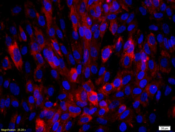 Paraformaldehyde-fixed (4%) Human Endothelial Cells were blocked with normal goat serum for 20mins at 37℃. The cells were then labeled with Biglycan Polyclonal Antibody, Unconjugated (bs-7552R) at 1:50, overnight at 4°C. Secondary antibody incubation was performed with Goat Anti-Rabbit IgG, Rhodamine B conjugated antibody (bs-0295G-RBITC) at a 1:200 dilution for 40 minutes at 37°C. DAPI (5ug/ml; blue) was used to stain the cell nuclei