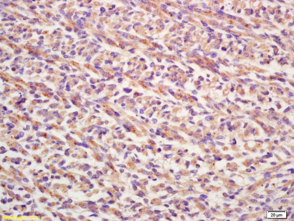 Formalin-fixed and paraffin embedded mouse embryo labeled with Rabbit Anti FGF8/HBGF-8 Polyclonal Antibody, Unconjugated (bs-0735R) at 1:200 followed by conjugation to the secondary antibody and DAB staining