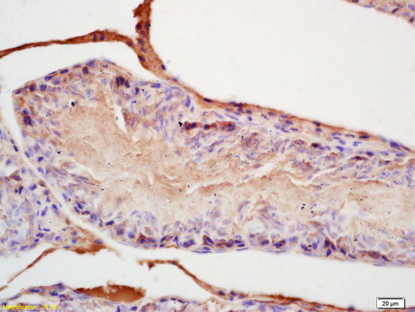 Formalin-fixed and paraffin embedded rat testis labeled with Rabbit Anti FGF8/HBGF-8 Polyclonal Antibody, Unconjugated (bs-0735R) at 1:200 followed by conjugation to the secondary antibody and DAB staining