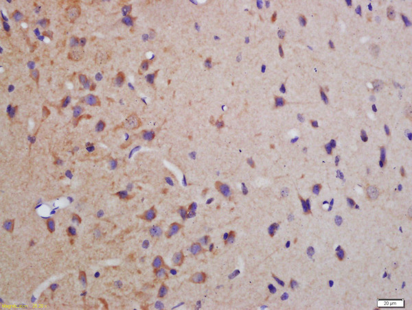 Formalin-fixed and paraffin embedded rat brain labeled with Anti-phospho-MBP(Thr232)Polyclonal Antibody, Unconjugated (bs-5474R) at 1:200 followed by conjugation to the secondary antibody and DAB staining\\n