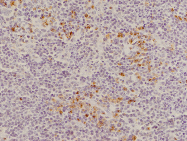 Image kindly submitted by Amy Beck as part of the free sample program. Formalin-fixed and paraffin embedded mouse spleen labeled with Rabbit Anti-CD8 Polyclonal Antibody, Unconjugated (bs-0648R) at 1:250.