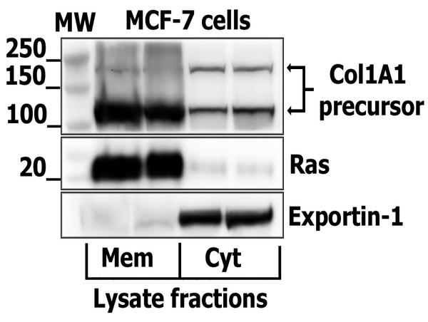 Image kindly submitted by Edita Aksamitiene as part of the Free Sample Program. MCF-7 cells probed with Rabbit Anti-Collagen IﾠPolyclonal antibody (bs-10423R)at 1:1000.